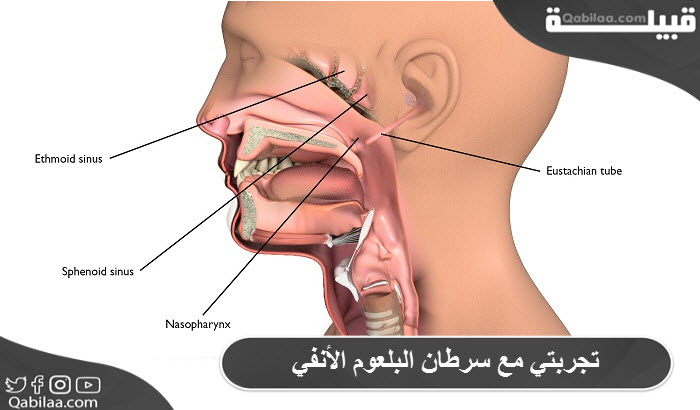 تجربتي مع سرطان البلعوم الأنفي