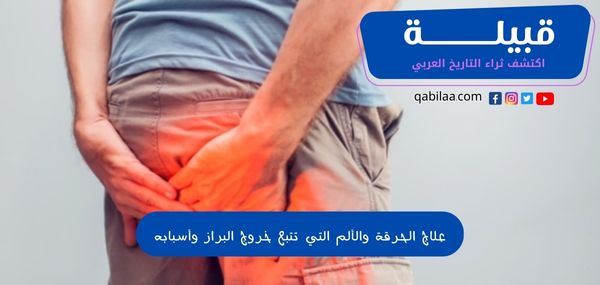 الحرقة التي تتبع خروج البراز