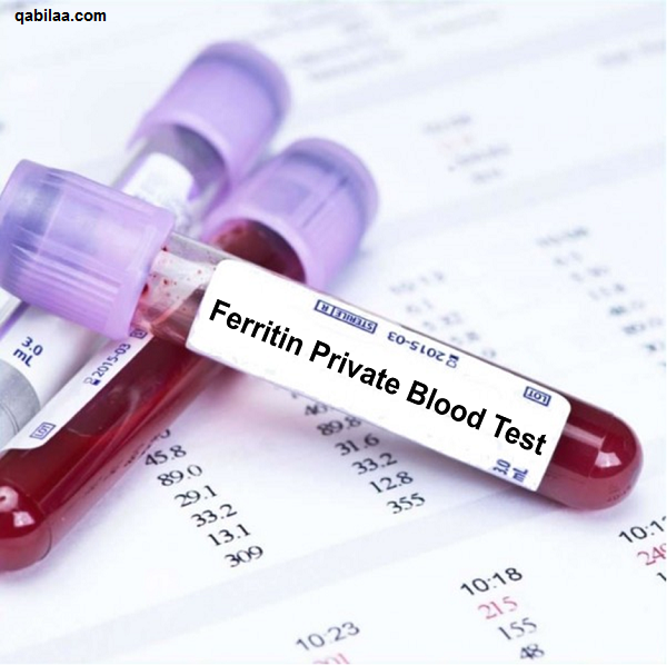 تحليل ferritin وأسباب إجرائه